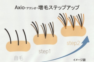 ボリュームアップは福岡の美容室【Axio-アクシオ-】にお任せ
